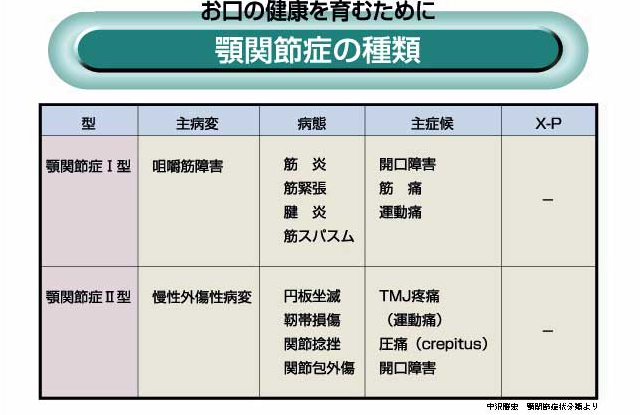 顎関節症の種類
