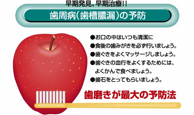 歯周病(歯槽膿漏)の予防