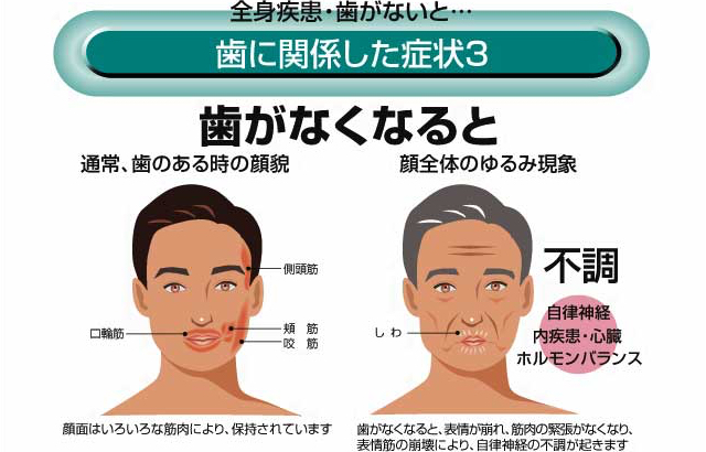 歯に関係した症状3