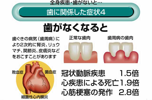 歯に関係した症状4