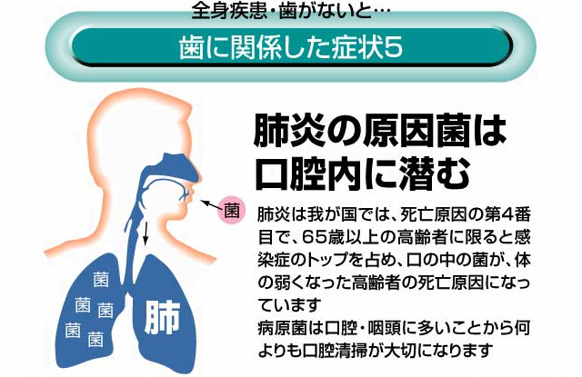 歯に関係した症状5