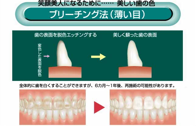 ブリーチング法(薄い目)
