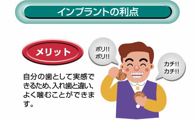 インプラントの利点