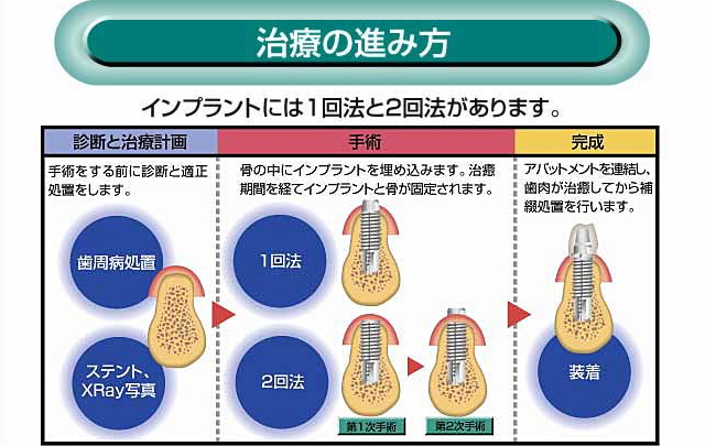 治療の進み方