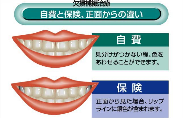 自費と保険、正面からの違い