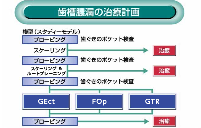 歯槽膿漏の治療計画